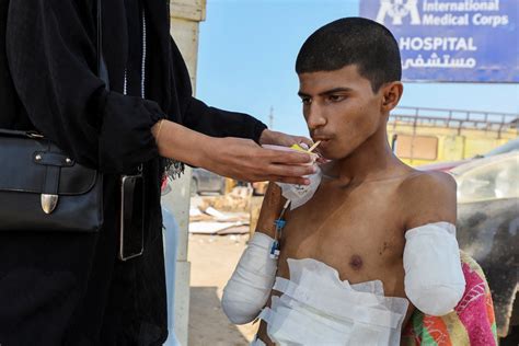 big ass femboy por|Gaza teen amputee recalls nightmare of losing arms in Israeli strike.